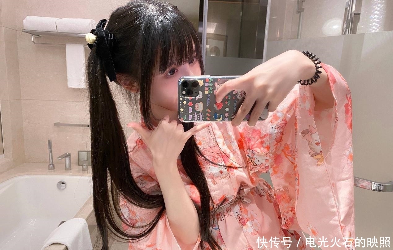 蔡萝莉发际线上移，为了美丽植发11个小时，一个毛囊报价12元