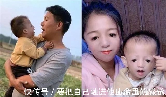 孩子|“鸟脸”妈妈执意生二胎,孩子不幸被遗传,一时的冲动毁孩子一生