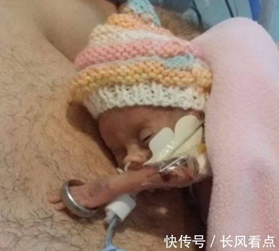 茉莉|生命斗士!出生体重不到1斤,手能穿过戒指,英迷你婴儿长大了!