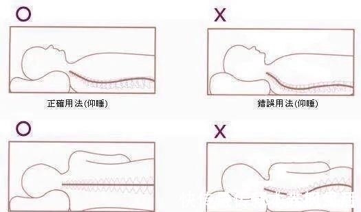 生理位|预防颈椎病,睡眠姿势很关键,听听医怎么说