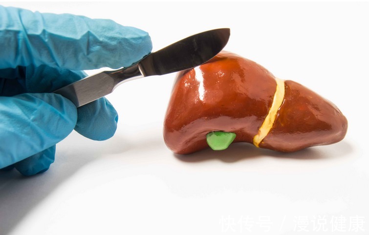 饮食习惯|乙肝一定会发展成肝癌?不瞒你说,养成4个习惯,肝脏会更健康