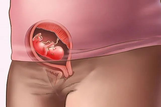 被迫|怀孕3个半月,B超发现是女孩被迫流产,你可曾想过胎儿会不会疼