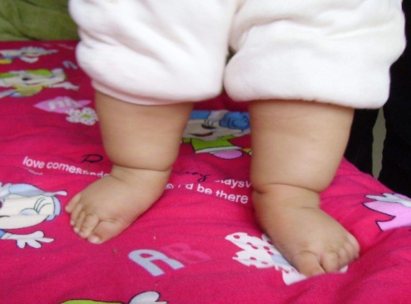 鞋子|3岁宝宝双脚变形,就是因为长时间穿这种鞋子,家长要重视了!