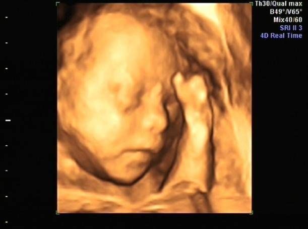 医生|为什么有些医院做四维彩超不让家属陪同这些原因,大家有权知道