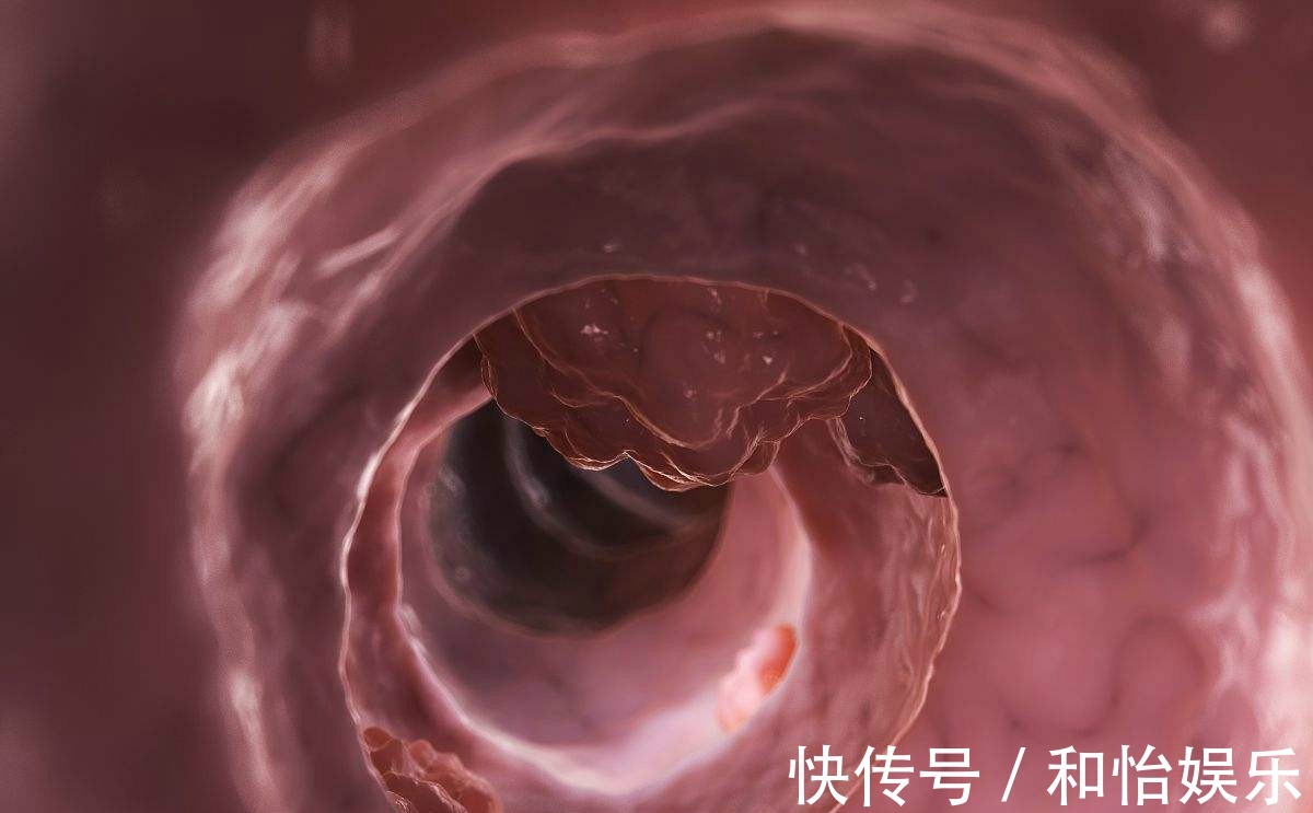 器质性便秘|四天一次大便是大肠癌吗，医生提醒，上厕所时三个信号才最关键