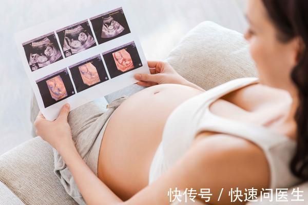 致畸|孕期进行了X线检查,有无致畸风险?不用慌,不妨看看医生的分析