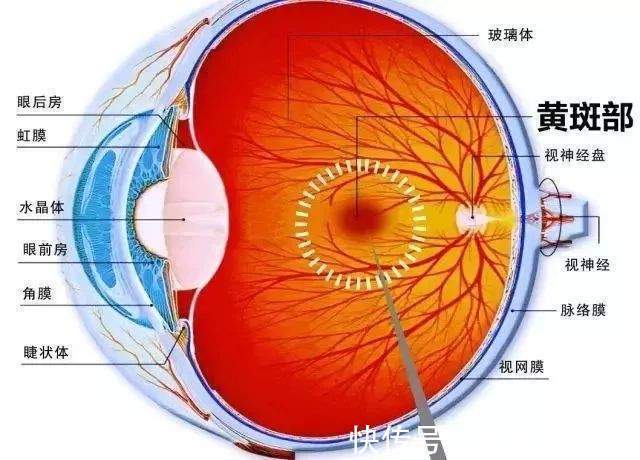 糖友们|糖尿病还可引发青光眼!头疼眼胀不容小觑
