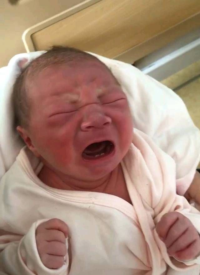 婴儿|这婴儿生下来有两颗牙母亲很自豪,但医生说你的痛苦才刚刚开始