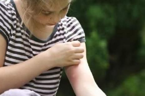 花露水|中国货又火了,在澳洲商店街中被抢购一空,直言实在太好用了