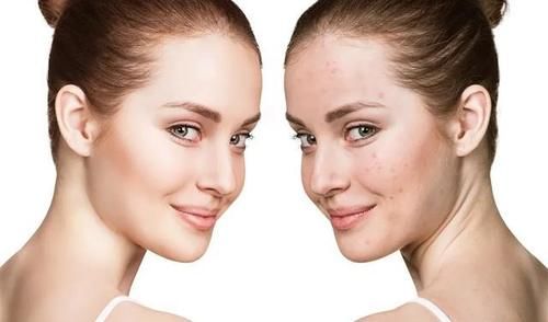 鼻子上挤出来的白色的，粘稠的丝状物，到底是啥东西？