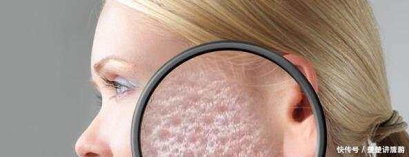 毛孔|只需一个小方法,脸上再也没螨虫,快回家除螨吧!