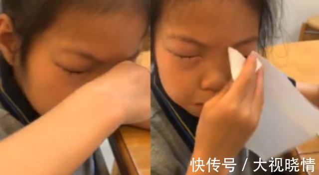 眼睛|怪事?宁波9岁女孩一做数学题眼睛四周就过敏,网友:我家也一样