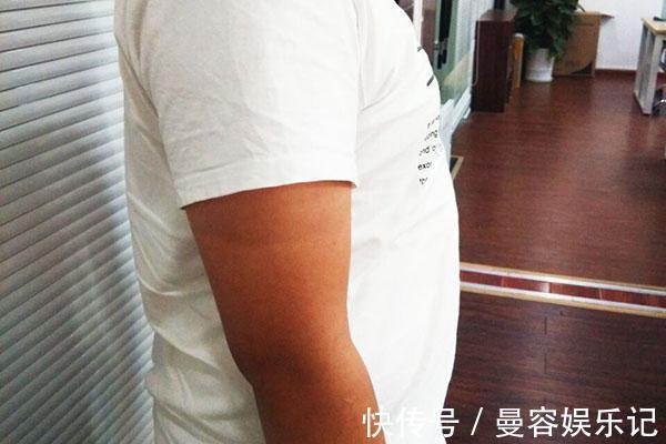 低血糖|42岁男子,坚持夜跑一年多,体重瘦下来了,却并不开心?