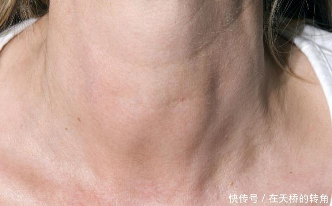 心肌炎是如何发生的离不开3大诱因，坚持做到4点预防心肌炎