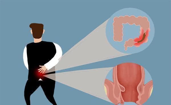 左下腹摸到一根硬肠子