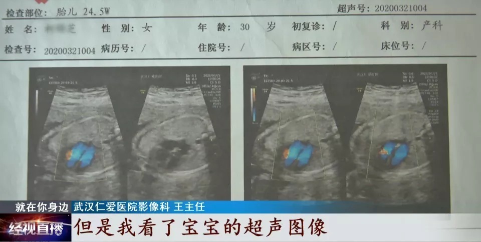 胎儿|宝宝出生缺失四根手指,家长质疑孕检误诊,涉事医院回复:不存在