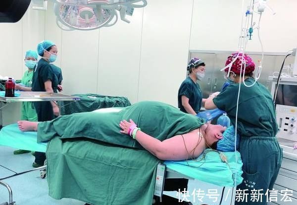 超重|超重产妇产房四道难关后，生下82斤巨婴，手术刀口全是油