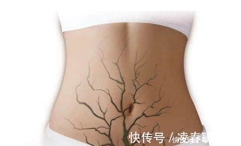 嘴唇|身上此2处变“黑”，可能是“子宫垃圾”过多，早知道早好