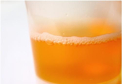 高尿酸|尿酸高，睡前有3个反常说明肾衰已不远，多吃1物，排尿酸安肾脏