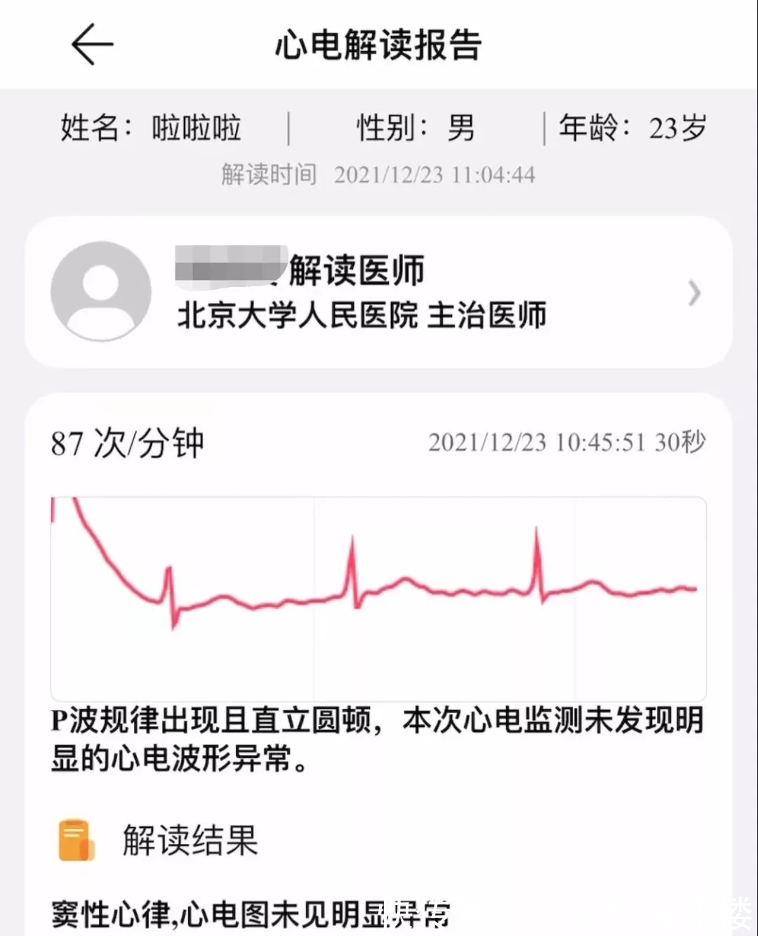 血压测量|华为WATCH D上手体验：独特气囊设计，戴在手上就能随时测血压