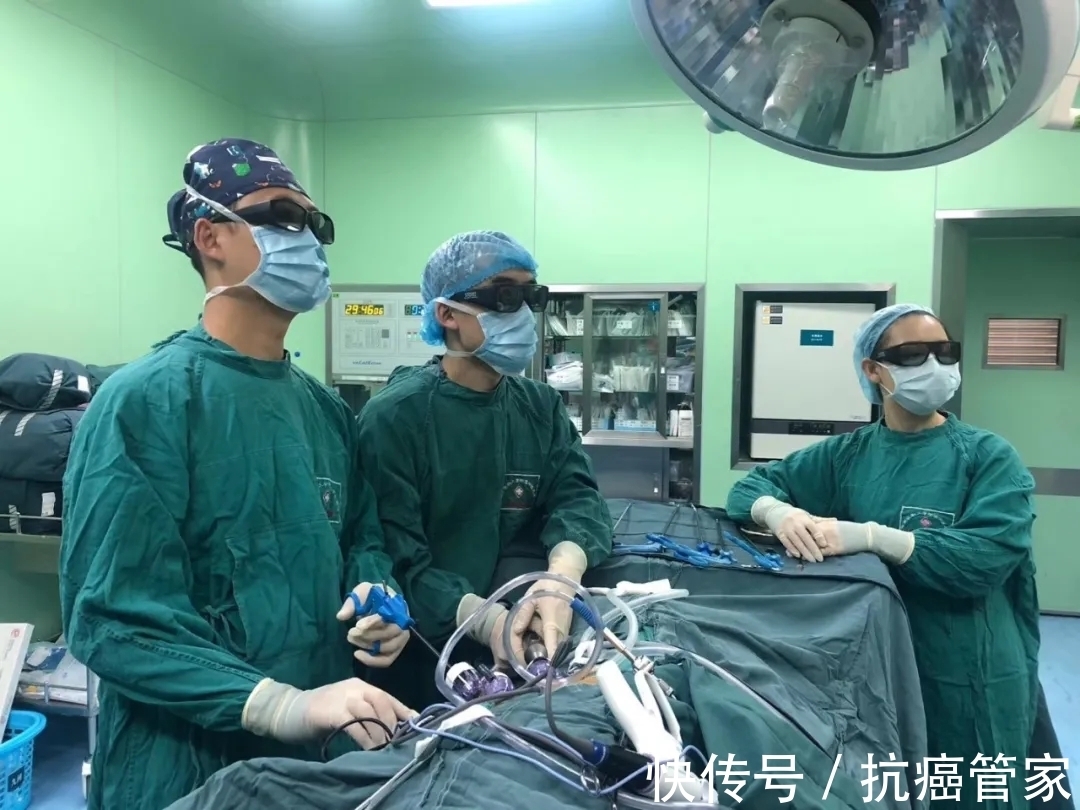 胸腔镜|刘浩医生:注意!要做肺癌手术,先了解这几点—抗癌管家