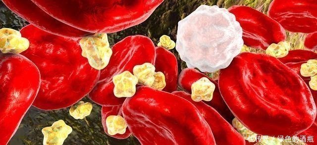 医生提醒:4件事不改,血脂照样往上涨,别大意