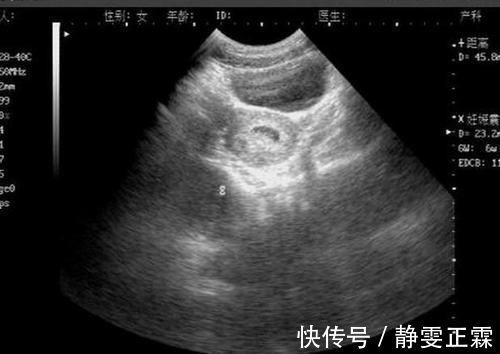 并非所有的怀孕都能第一时间发现,准妈妈要注意的,按周来感觉