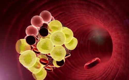 薏仁|血脂增高不用急，谨记多吃几样食物，血脂可能“悄悄”降下去