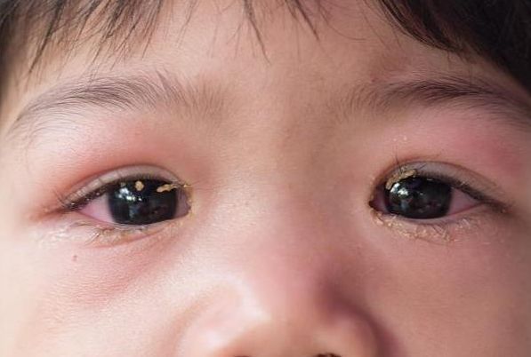 男孩|14岁男孩1年长个15CM,医生:坚持做这件事,孩子长高个发育好