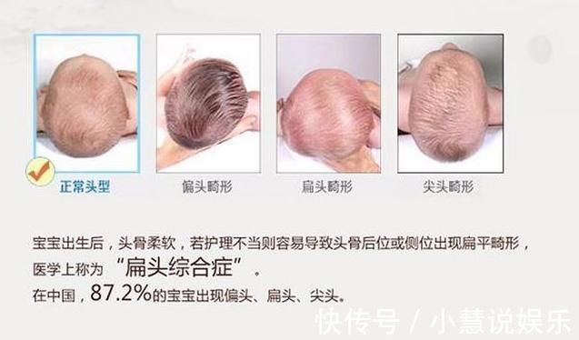 吸奶器|看似实用,买回家就后悔的4种母婴用品,你被“坑”过吗?