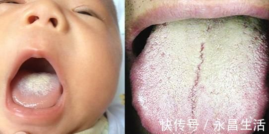 食物|孩子身体出现这5个“信号”，暗示积食比较严重，父母要心中有数