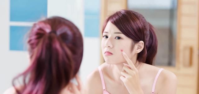 洁白|又长痘痘了怎么办可以用手挤吗注意以下几点,还你洁白肌肤