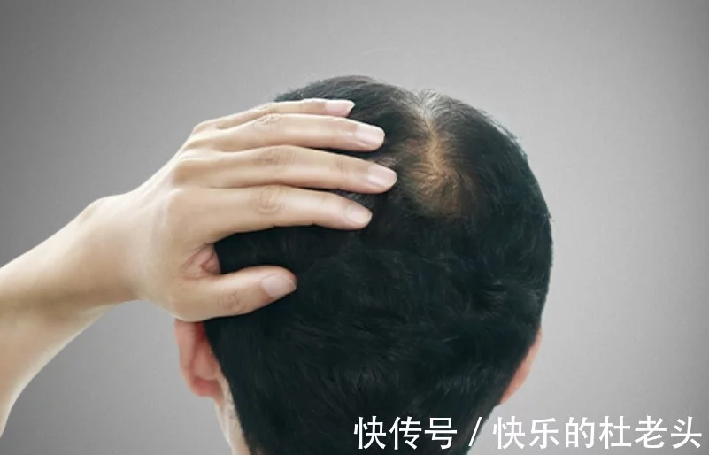 老是“掉发”，非是头发自然脱落，坚持3个好习惯，行之有效（总掉发怎么办?）