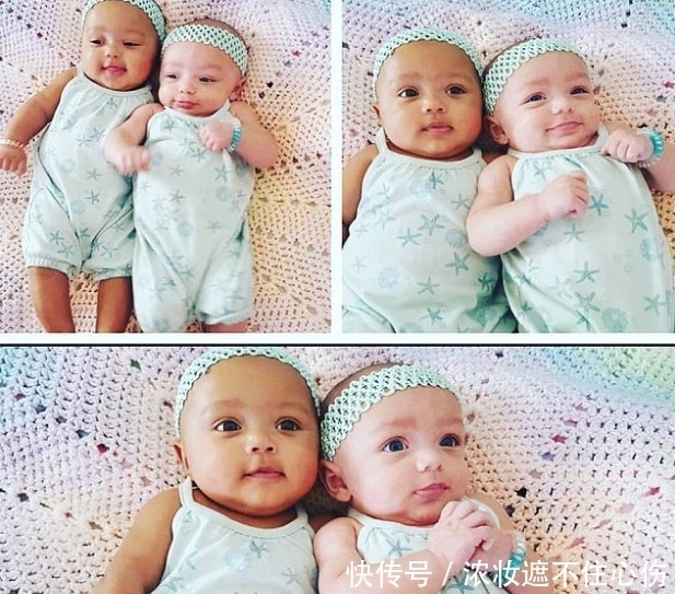 卵双胞|小夫妻生了双胞胎，竟发现是黑白两种颜色，结果让人开心不已！