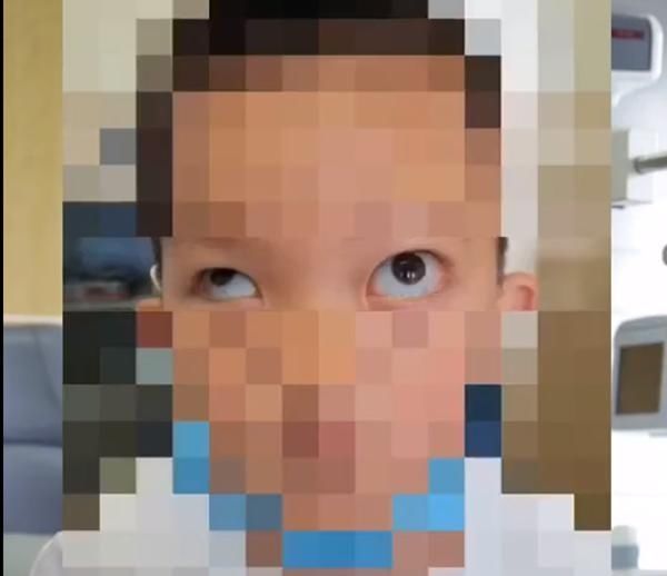 特效|可怕6岁男孩模仿短视频特效抠出眼球,犹如金鱼眼鼓出