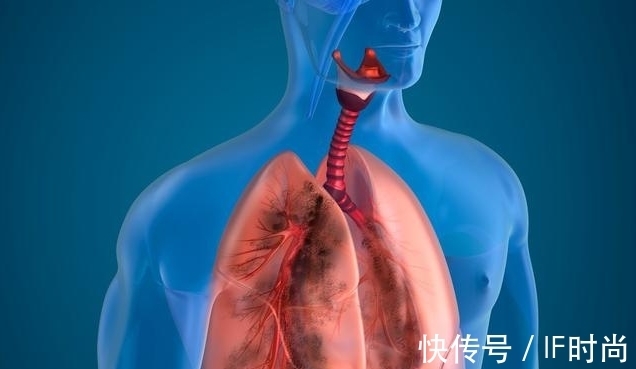 复发|这5种癌症,术后最容易复发和转移!如何预防?这3点牢记在心中