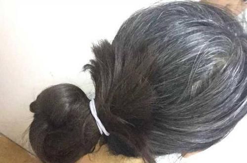 白头发拔1根长10根?3个“狠角色”,白发、脱发全拿下,显年轻