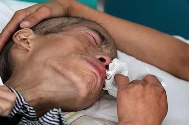 患者|肝癌的扩散速度有多快医生提醒三招预防让肝无忧