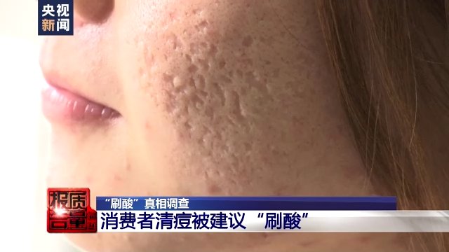 ph值|女生们注意了！刷酸真的有用吗？小心“毁容”……