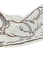 腰间盘突出!用这个简单方法,见效快!不花钱,在家就能自我治疗