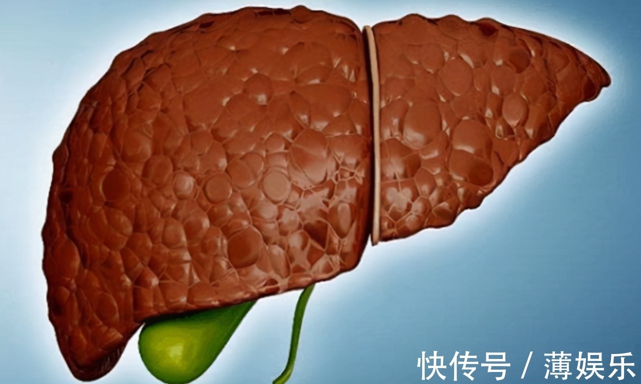 油脂|多走路能降血脂医生提醒日常多吃这4物，或比走路效果好