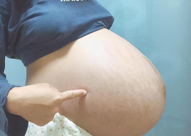 入睡|什么时候胎动最频繁?盘点胎儿6个“好动”时刻,晚上不是最多的