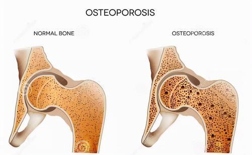 食物|原来喝“骨头汤”不是最补钙？真正补钙的是这5种食物，出乎你的意料