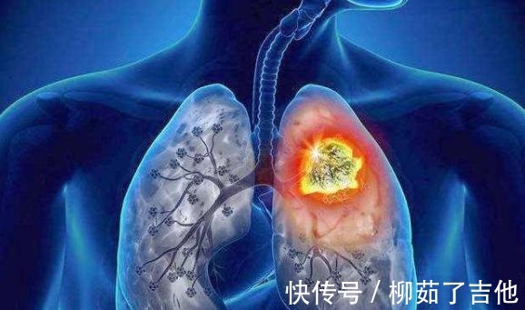生冷食物|萝卜是结节的“加速剂”吗医生若不想结节癌变,尽量少吃5物