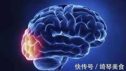 脑梗|脑梗塞总是静悄悄的,医生再次忠告:牢记这4点,血管才会更好