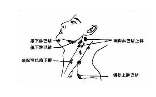 肺部肿瘤难被发现?双腿或早就发出“信号”,被很多人忽视了