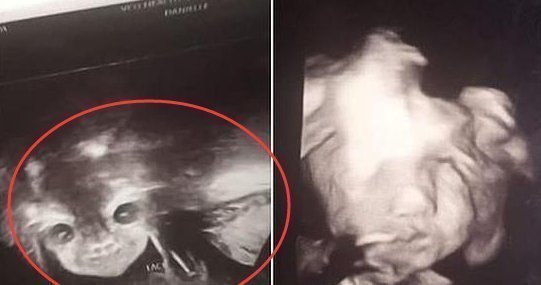 子宫内|孕24周B超检查，当看到宝宝的样子后，孕妈有些吓到了