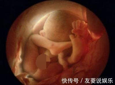 五个月|身怀五个月孕妇下身”见红“误以流产,急忙到医院却让医生憋着笑