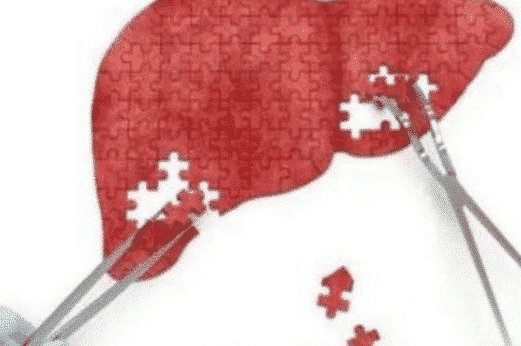  身体|身体出现这3个症状，很遗憾，肝硬化可能进入晚期了！