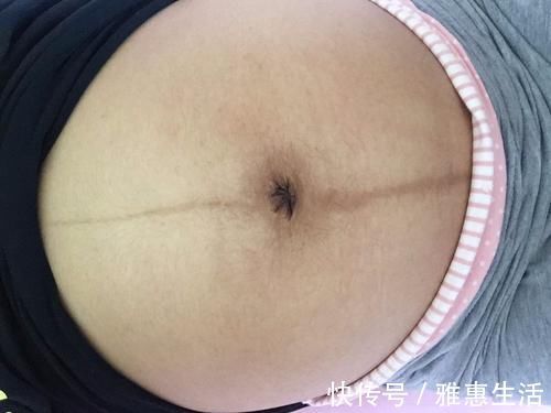 发育|想了解胎儿发育情况,可以看看孕妈的肚脐,“凸出来”的要恭喜了